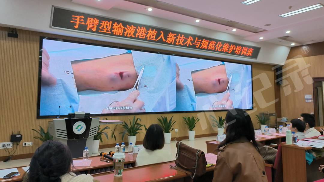 输液港手术直播